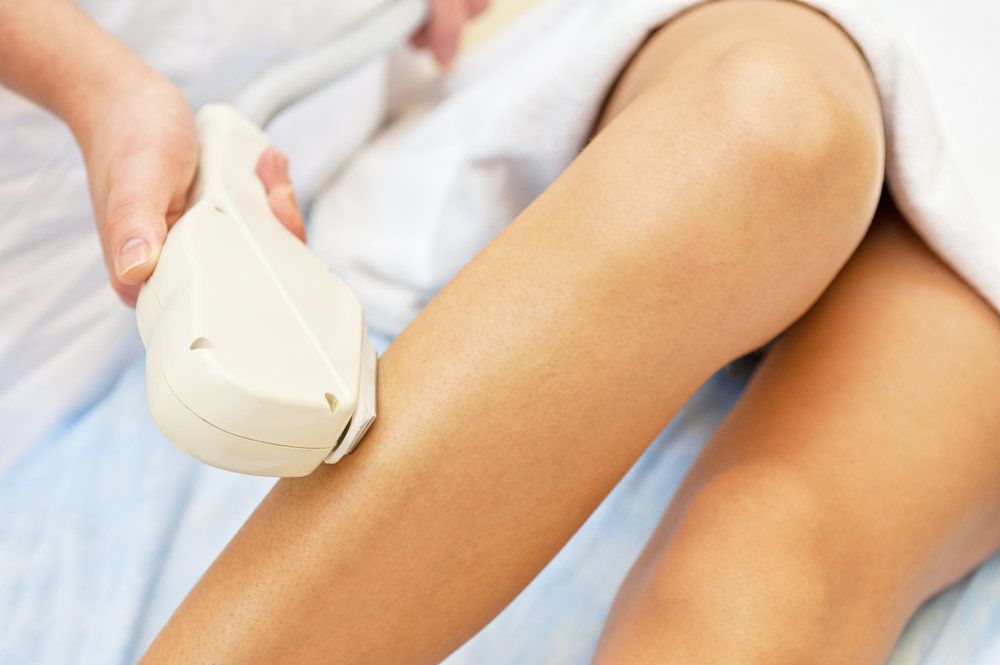Woman undergoing laser hair removal